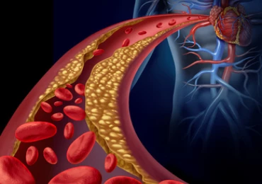 Subklinická hypotyreóza zřejmě zvyšuje riziko diabetu i kardiovaskulárních onemocnění
